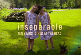 Inseparable: Ten Years Joined At The Head