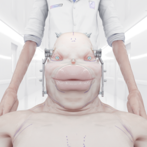 CATERPILLARPLASTY CATERPILLARPLASTY