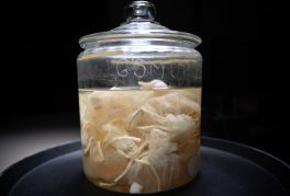 The Man Who Stole Einstein’s Brain